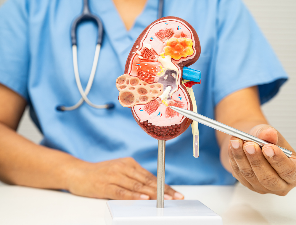 BPH (İyi Huylu Prostat Büyümesi) Tedavi Yaklaşımları: Modern Ürolojideki Gelişmeler